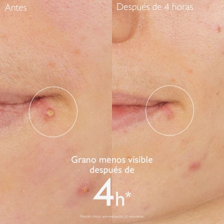 Caudalie Vinopure Stop Boutons Salicylique 15ml